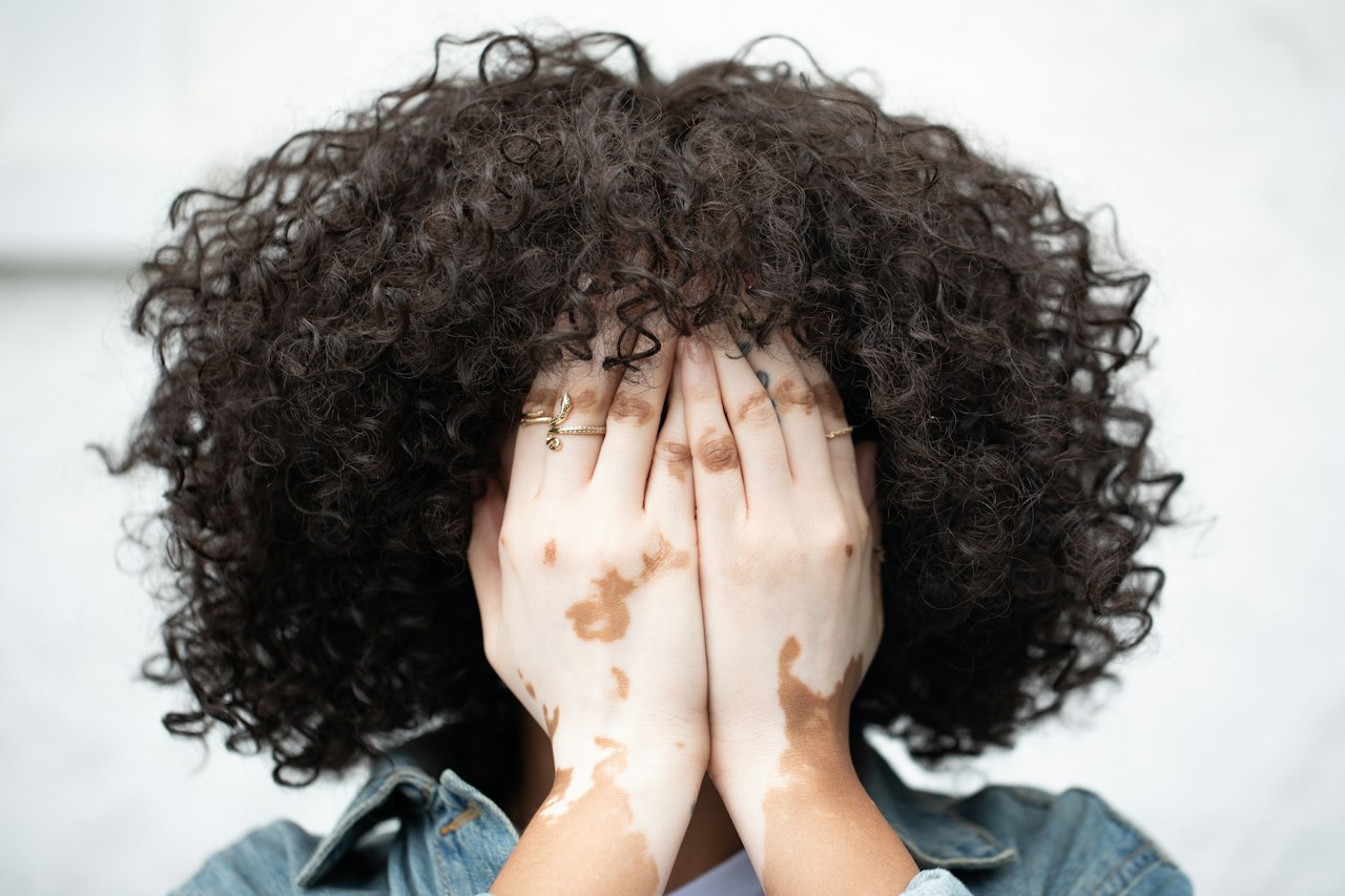 Here is everything you need to know about Batana Oil for hair growth. Pictured: a woman with natural hair putting her hands over her face.