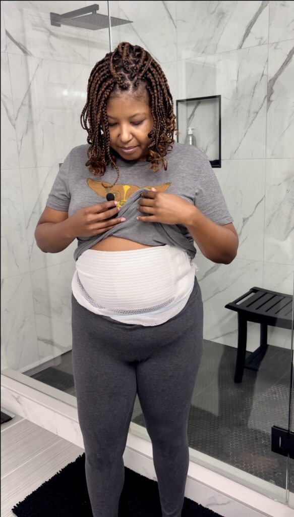 Black woman shows stomach after hysterectomy surgery.